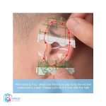چسب گوش کودک مخصوص حمام آلکه ALKE - Image 2