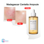 سرم معجزه سنتلا ماداگاسکار | CENTELLA MADAGASCAR حجم 100 میل - Image 2